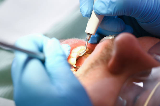 Best Emergency Root Canal Treatment in Park City, KS