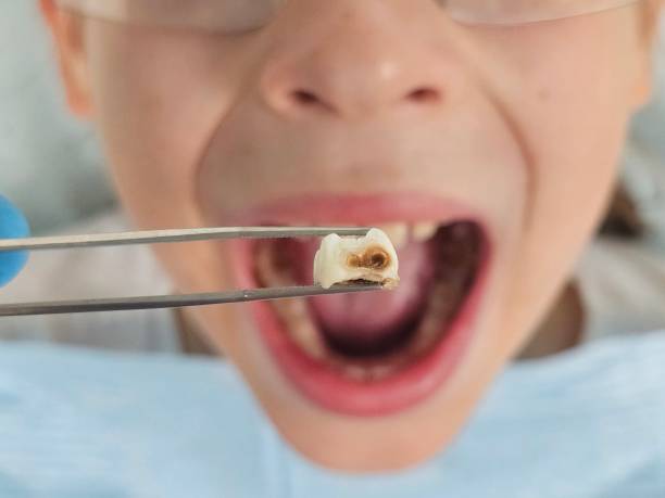 Best Emergency Broken Tooth Repair in Park City, KS